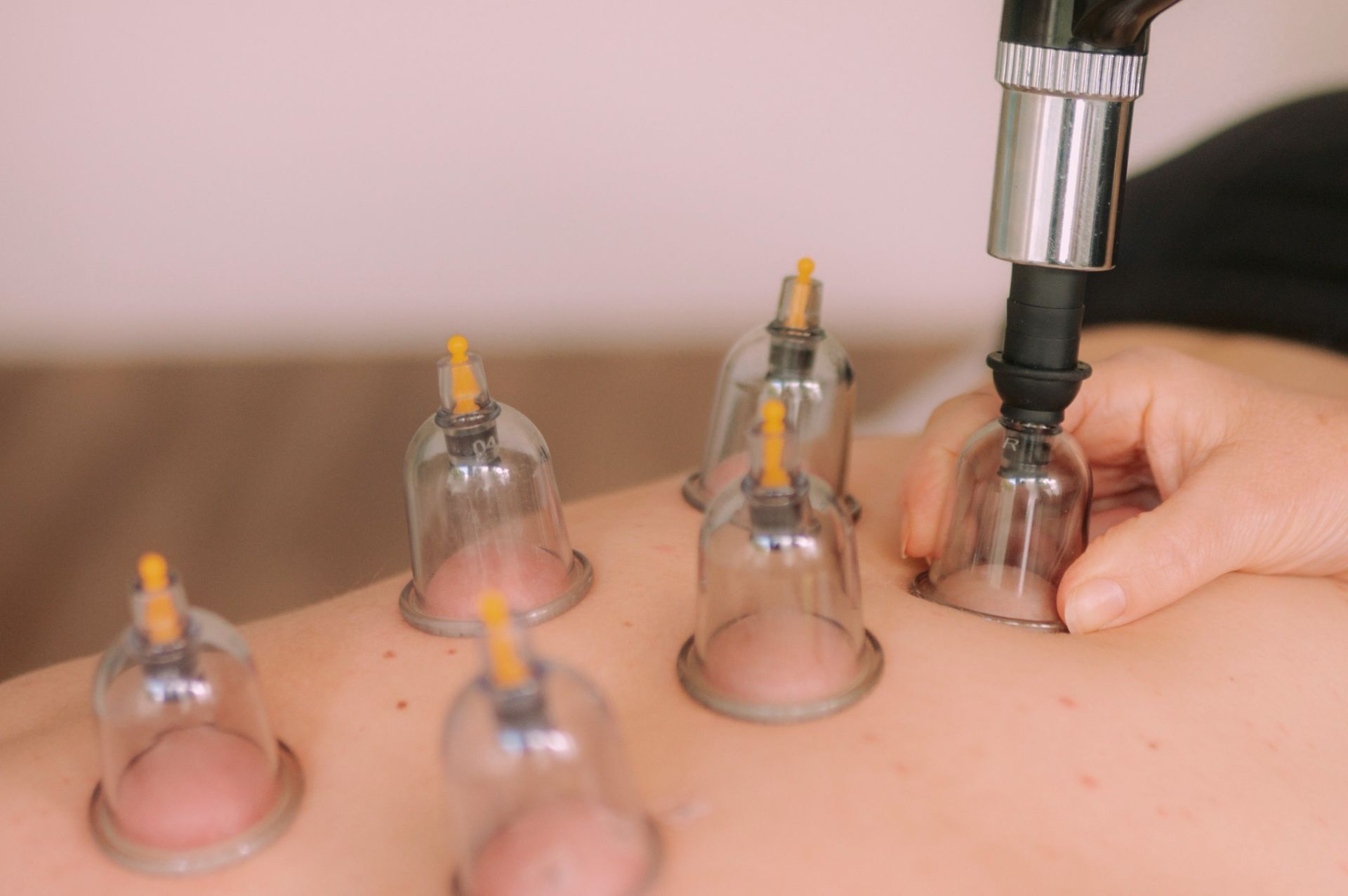 Kinesiotaping mit grünem und rotem Tape an Oberarm eines Patienten